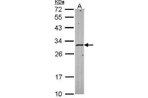 WB Image Sample (30 ug of whole cell lysate) A: Hela 12% SDS PAGE antibody diluted at 1:1000 (HLA-DMA Antikörper)