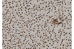 ABIN6277585 at 1/100 staining Rat liver tissue by IHC-P. (NQO2 Antikörper  (N-Term))