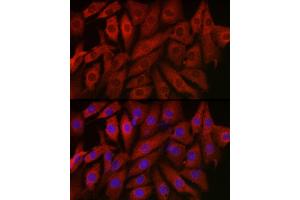 Immunofluorescence analysis of NIH/3T3 cells using Endothelin 1 Rabbit pAb (ABIN3021075, ABIN3021076, ABIN3021077 and ABIN6213940) at dilution of 1:50 (40x lens).