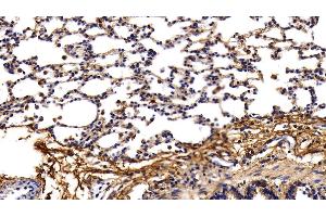Detection of PINP in Rat Lung Tissue using Polyclonal Antibody to Procollagen I N-Terminal Propeptide (PINP) (PINP Antikörper  (AA 23-151))