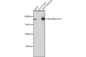 Immunoprecipitation analysis of 600 μg extracts of Mouse brain cells using 3 μg Neurofilament H antibody (ABIN6129638, ABIN6144512, ABIN6144513 and ABIN6224502). (NEFH Antikörper  (AA 821-1020))