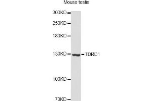 Western blot analysis of extracts of mouse testis, using TDRD1 Antibody. (TDRD1 Antikörper)