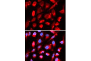 Immunofluorescence analysis of U2OS cells using UROD antibody. (UROD Antikörper  (AA 1-367))