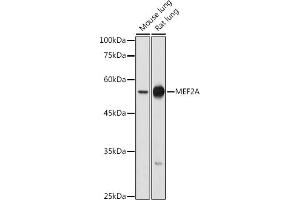Western blot analysis of extracts of various cell lines, using MEF2A antibody (ABIN6134843, ABIN6143710, ABIN6143713 and ABIN6215627) at 1:500 dilution. (MEF2A Antikörper  (AA 1-100))