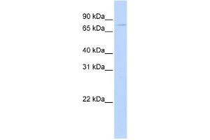 WB Suggested Anti-APP Antibody Titration:  0. (APP Antikörper  (Middle Region))