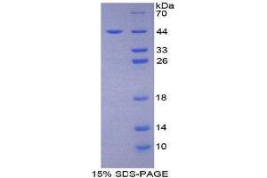 SDS-PAGE (SDS) image for Lactoperoxidase (LPO) (AA 244-346) protein (His tag,GST tag) (ABIN1080201)