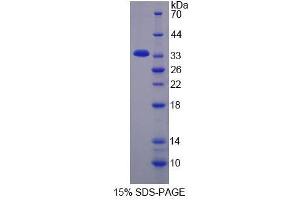Image no. 1 for Keratocan (KERA) (AA 21-292) protein (His tag) (ABIN6238585) (KERA Protein (AA 21-292) (His tag))
