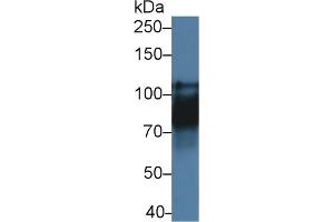 Detection of CDH16 in Rat Kidney lysate using Polyclonal Antibody to Cadherin 16 (CDH16) (Cadherin-16 Antikörper  (AA 353-617))