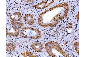 IHC analysis of GLIS1 using anti-GLIS1 antibody (ABIN7599501). (GLIS1 Antikörper  (AA 1-620))