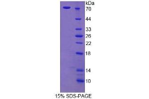 Image no. 1 for Cortactin (CTTN) (AA 1-509) protein (His tag) (ABIN6238506)