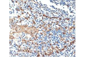 Immunohistochemistry of paraffin-embedded Human tonsil using HSPA1A Monoclonal Antibody at dilution of 1:100 (40x lens). (HSP70 1A Antikörper)