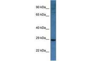 Image no. 1 for anti-BCL2/adenovirus E1B 19kDa Interacting Protein 3-Like (BNIP3L) (AA 92-141) antibody (ABIN6747290) (BNIP3L/NIX Antikörper  (AA 92-141))