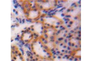 Used in DAB staining on fromalin fixed paraffin-embedded Kidney tissue (CTGF Antikörper  (AA 25-348))