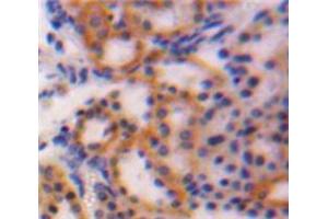 Used in DAB staining on fromalin fixed paraffin-embedded Kidney tissue