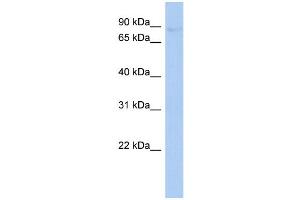 WB Suggested Anti-PLOD2 Antibody Titration:  0. (PLOD2 Antikörper  (Middle Region))