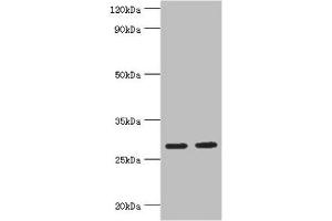 Western blot All lanes: Ubiquitin-conjugating enzyme E2 J2 antibody at 5 μg/mL Lane 1: HepG2 whole cell lysate Lane 2: Rat small intestine tissue Secondary Goat polyclonal to rabbit IgG at 1/10000 dilution Predicted band size: 29, 25, 31 kDa Observed band size: 29 kDa (UBE2J2 Antikörper  (AA 1-230))