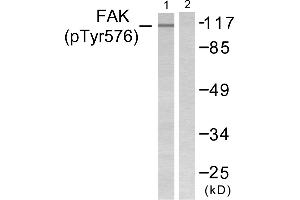 Western blot analysis of extracts from NIH/3T3 cells, using FAK (Phospho-Tyr576) Antibody (#A0426). (FAK Antikörper  (pTyr576))