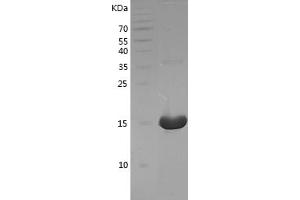 Western Blotting (WB) image for Tumor Necrosis Factor alpha (TNF alpha) (AA 78-232) protein (His tag) (ABIN7125541)