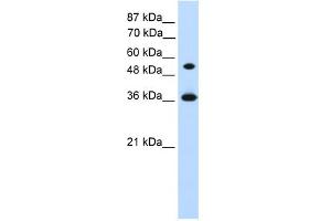 WB Suggested Anti-HOXC11 Antibody Titration:  1. (HOXC11 Antikörper  (Middle Region))