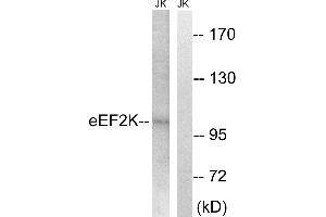 Western blot analysis of extracts from Jurkat cells, using eEF2K (Ab-359) antibody.