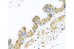 Immunohistochemistry of paraffin-embedded Human trachea using PCDHA12 Polyclonal Antibody at dilution of 1:100 (40x lens). (PCDHA12 Antikörper)