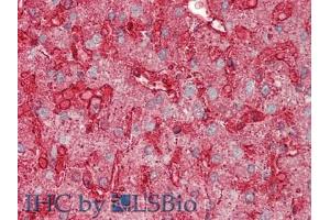 IHC-P analysis of Human Liver Tissue, with HE staining. (Annexin IV Antikörper  (AA 11-164))
