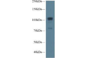Western Blot; Sample: Human A549 cell lysate; Primary Ab: 1µg/ml Rabbit Anti-Rat NOS1 Antibody Second Ab: 0. (NOS1 Antikörper  (AA 468-616))