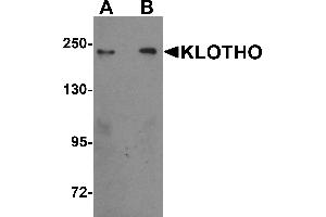 Western Blotting (WB) image for anti-Klotho (KL) (Middle Region) antibody (ABIN1030975) (Klotho Antikörper  (Middle Region))