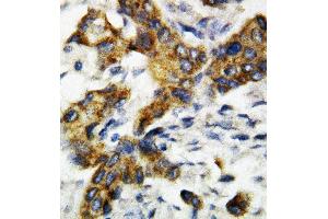 Anti-BAK antibody, IHC(P) IHC(P): Rat Lung Tissue (BAK1 Antikörper  (Middle Region))