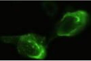 Anti-NEUROG3 mouse monoclonal antibody (NEUROG3) immunofluorescent staining of HeLa cells transiently transfected by pCMV6-ENTRY NEUROG3 (RC224767). (Neurogenin 3 Antikörper)