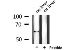 Western blot analysis of extracts from rat liver, using PLAT Antibody. (PLAT Antikörper  (C-Term))