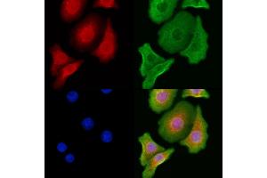 ABIN6262378 and ABIN6276997 staining Hela cells by IF/ICC. (HSD17B2 Antikörper  (C-Term))