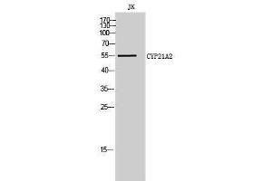 Western Blotting (WB) image for anti-Cytochrome P450, Family 21, Subfamily A, Polypeptide 2 (CYP21A2) (Internal Region) antibody (ABIN3184165)