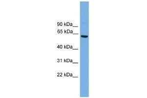 WB Suggested Anti-Cbfa2t2 Antibody Titration:  0. (CBFA2T2 Antikörper  (Middle Region))