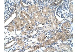 FBXL7 antibody was used for immunohistochemistry at a concentration of 4-8 ug/ml to stain Epithelial cells of renal tubule (arrows) in Human Kidney.
