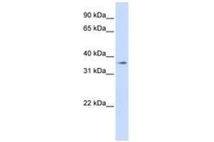 Image no. 1 for anti-Transmembrane Protein 30B (TMEM30B) (AA 108-157) antibody (ABIN6740901) (TMEM30B Antikörper  (AA 108-157))