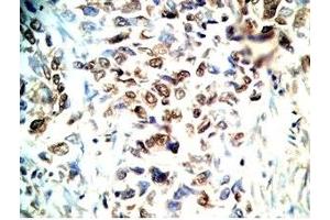 Immunohistochemistry (IHC) image for anti-Cathelicidin Antimicrobial Peptide (CAMP) (AA 140-173) antibody (ABIN2873275)