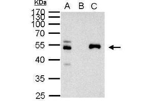 IP Image PAX8 antibody immunoprecipitates PAX8 protein in IP experiments.