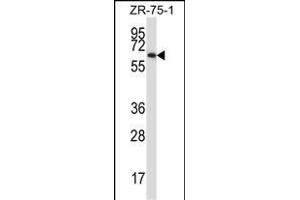 P17 Antibody (C-term) (ABIN657916 and ABIN2846863) western blot analysis in ZR-75-1 cell line lysates (35 μg/lane). (MMP17 Antikörper  (C-Term))