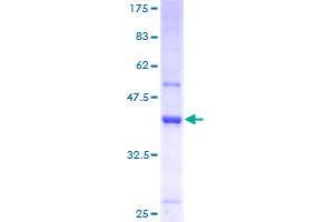 Image no. 1 for tRNA Methyltransferase 11-2 (TRMT112) (AA 1-125) protein (GST tag) (ABIN1307237) (TRMT112 Protein (AA 1-125) (GST tag))