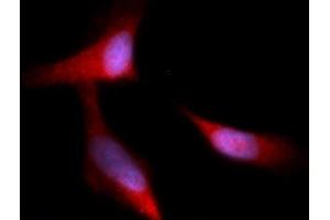 Image no. 1 for anti-Complement Factor H (CFH) antibody (APC) (ABIN5565312) (Complement Factor H Antikörper  (APC))