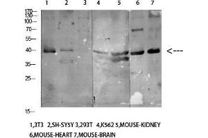 Western Blot (WB) analysis of specific cells using Antibody diluted at 1:1000. (KIR3DL1 Antikörper)