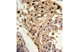 Formalin-fixed and paraffin-embedded human testis tissue reacted with KLF6 Antibody , which was peroxidase-conjugated to the secondary antibody, followed by DAB staining. (KLF6 Antikörper  (C-Term))