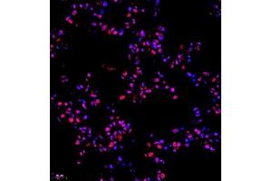Immunofluorescence (Paraffin-embedded Sections) (IF (p)) image for anti-RNA Binding Motif Protein 45 (RBM45) antibody (ABIN7075477)