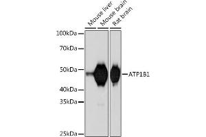 Western blot analysis of extracts of various cell lines, using B1 Rabbit mAb (ABIN7265772) at 1:1000 dilution. (ATP1B1 Antikörper)