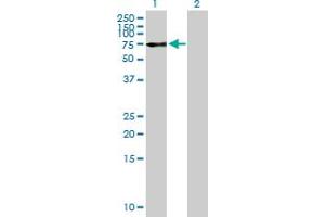 Western Blot analysis of OPTN expression in transfected 293T cell line by OPTN MaxPab polyclonal antibody. (OPTN Antikörper  (AA 1-577))