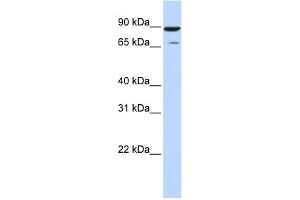 WB Suggested Anti-HIPK4 Antibody Titration: 0. (HIPK4 Antikörper  (Middle Region))