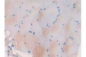 DAB staining on IHC-P; Samples: Mouse Skeletal muscle Tissue (Myosin IB Antikörper  (AA 779-1040))