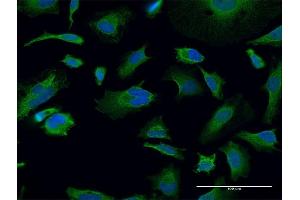Immunofluorescence (IF) image for anti-Transglutaminase 2 (C Polypeptide, Protein-Glutamine-gamma-Glutamyltransferase) (TGM2) (AA 1-120) antibody (ABIN520889)