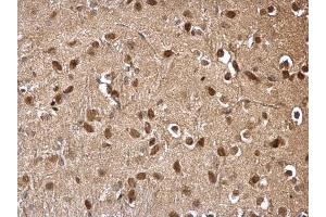 IHC-P Image DDB1 antibody [C3], C-term detects DDB1 protein at cytosol and nucleus on mouse hind brain by immunohistochemical analysis. (DDB1 Antikörper  (C-Term))